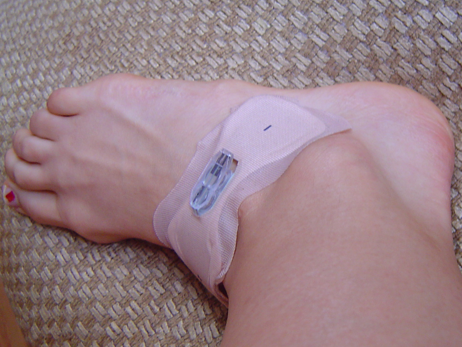How Does Iontophoresis Patch Work Quilts